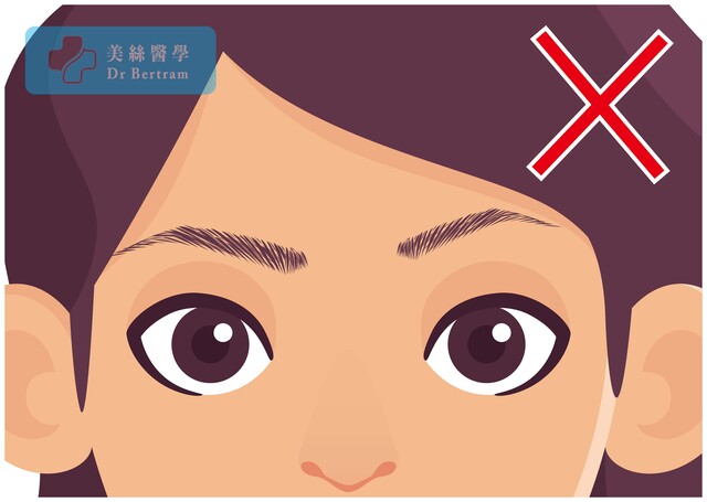 不對稱示例