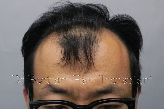 臨床個案：30歲男性