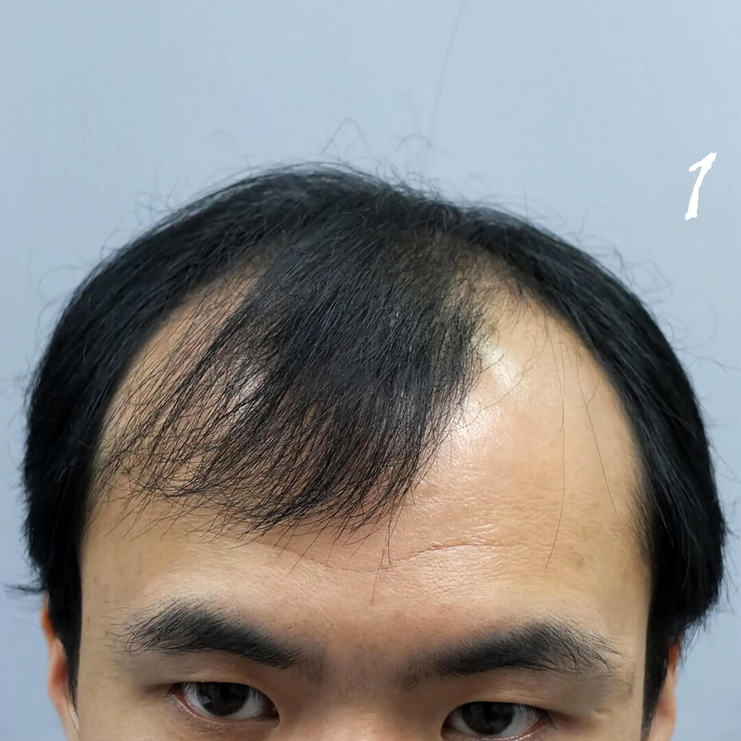 正面角度